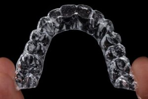 clear aligner braces