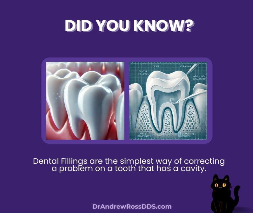 dental-fillings